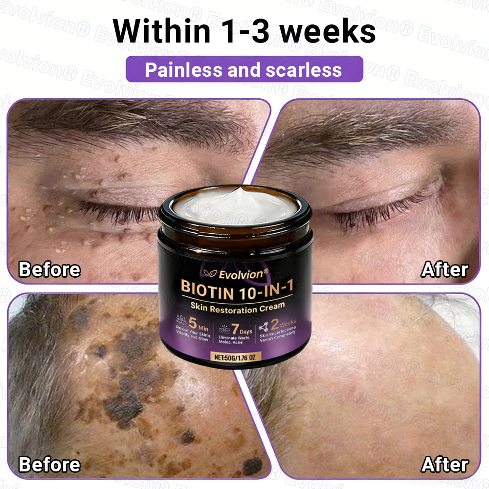 Made and Shipped from UK ✨Evolvion® Biotin 10-in-1 Skin Restoration Cream 🍀