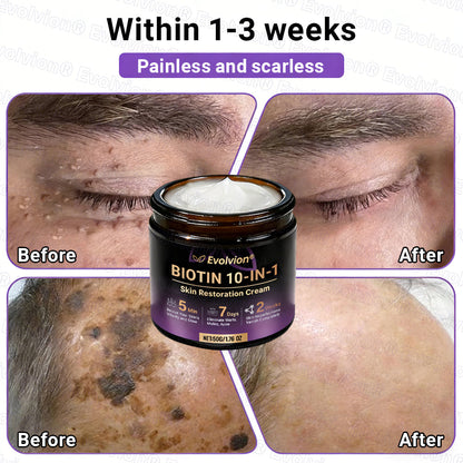 Made and Shipped from UK ✨Evolvion® Biotin 10-in-1 Skin Restoration Cream 🍀