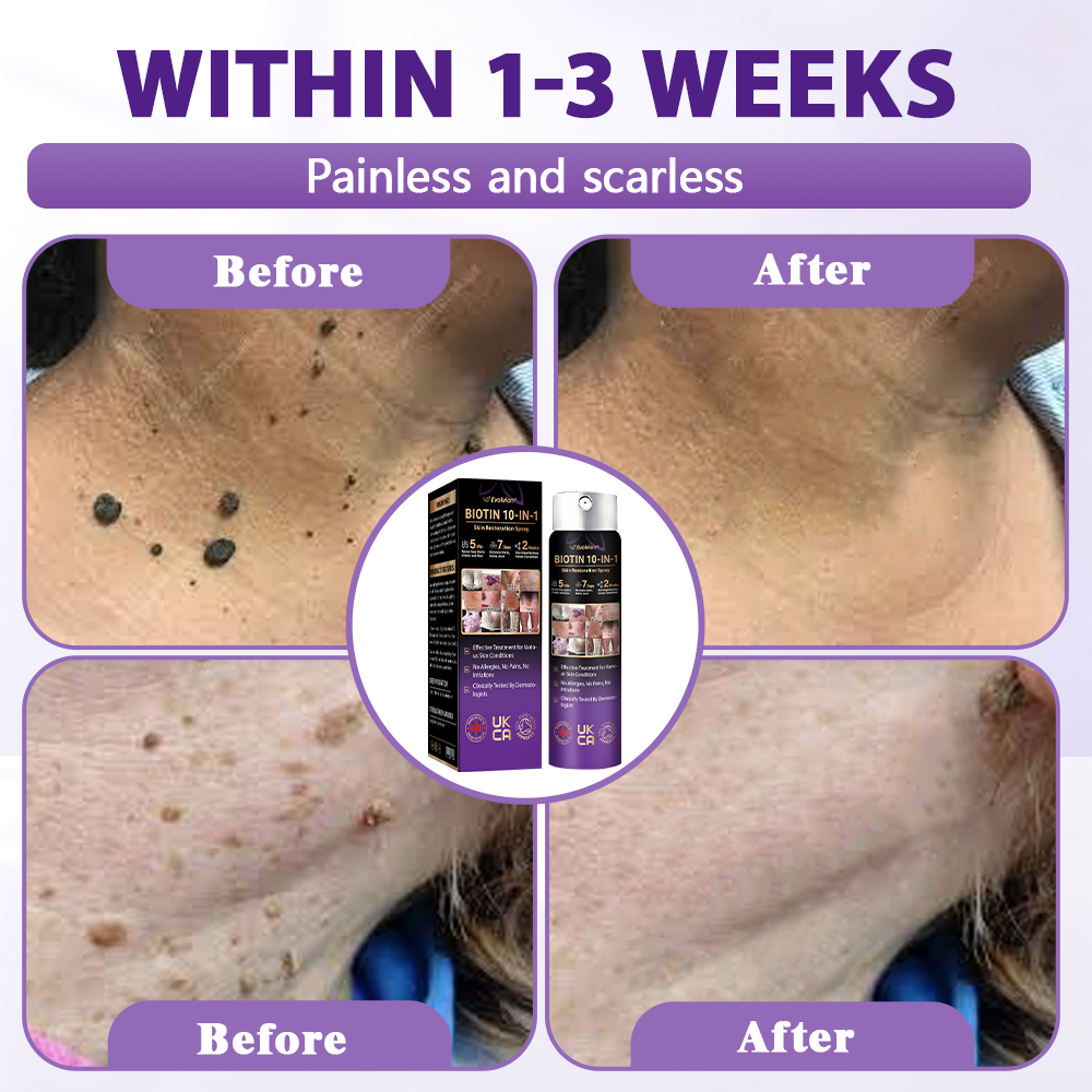 Made and shipped from the United Kingdom ✨Evolvion® Biotin 10-in-1 Skin Restoration Spray 🔥