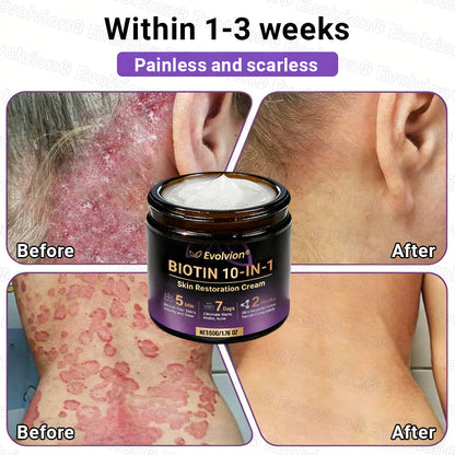 Made and Shipped from UK ✨Evolvion® Biotin 10-in-1 Skin Restoration Cream 🍀