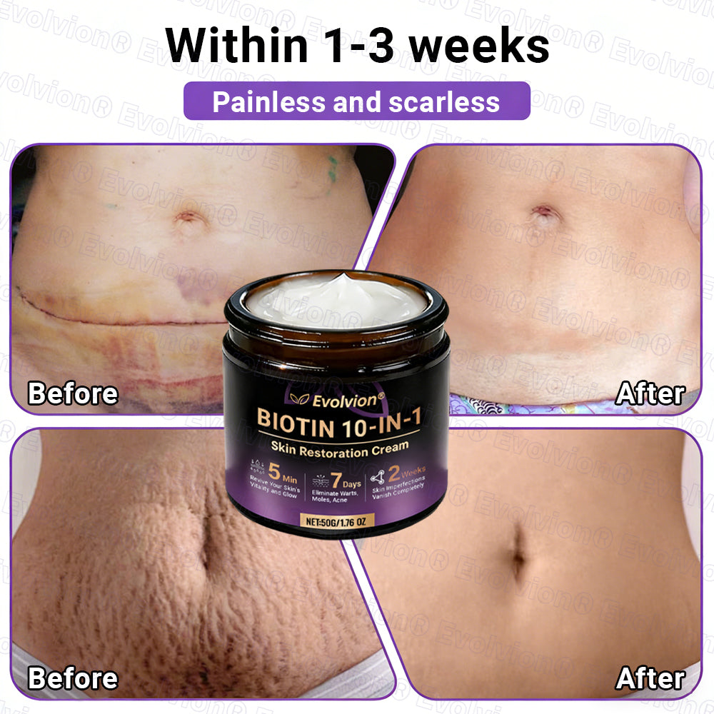 Made and Shipped from UK ✨Evolvion® Biotin 10-in-1 Skin Restoration Cream 🍀