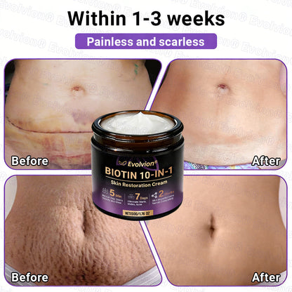 Made and Shipped from UK ✨Evolvion® Biotin 10-in-1 Skin Restoration Cream 🍀