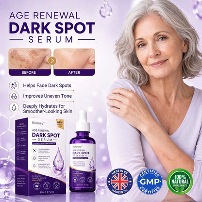 ✨ Rolimey® Age Renewal Dark Spot Serum — Infused with 10% Niacinamide, Tranexamic Acid & Hyaluronic Acid for Brighter, Smoother-Looking Mature Skin