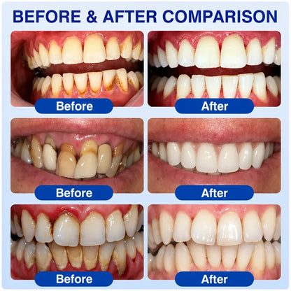 Pheromex® 🏅GumRevive Periodontal Care Gel