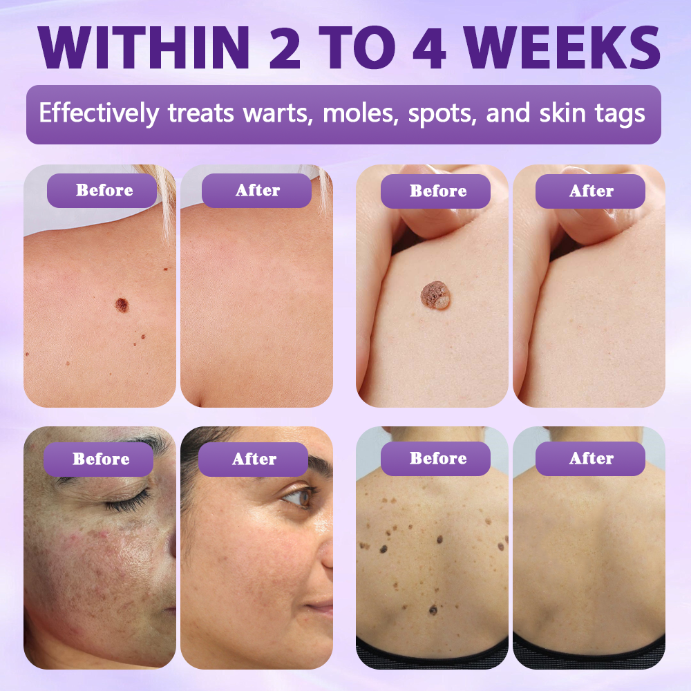 Made and shipped from the United Kingdom ✨Evolvion® Biotin 10-in-1 Skin Restoration Spray 🔥