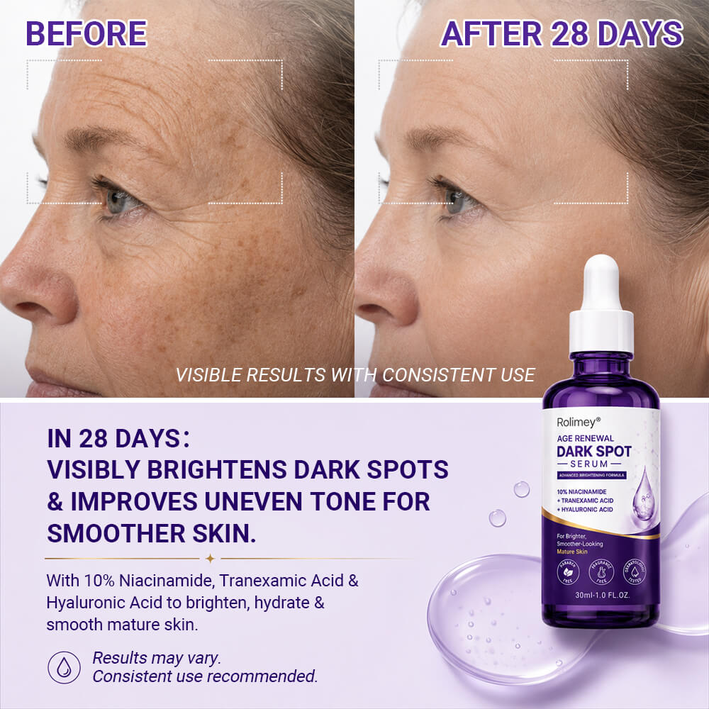 ✨ Rolimey® Age Renewal Dark Spot Serum — Infused with 10% Niacinamide, Tranexamic Acid & Hyaluronic Acid for Brighter, Smoother-Looking Mature Skin