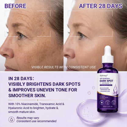 ✨ Rolimey® Age Renewal Dark Spot Serum — Infused with 10% Niacinamide, Tranexamic Acid & Hyaluronic Acid for Brighter, Smoother-Looking Mature Skin