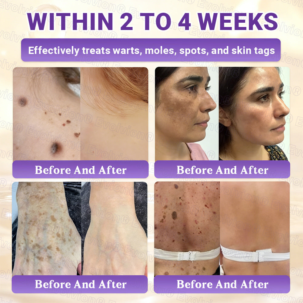 Made and Shipped from UK ✨Evolvion® Biotin 10-in-1 Skin Restoration Cream 🍀