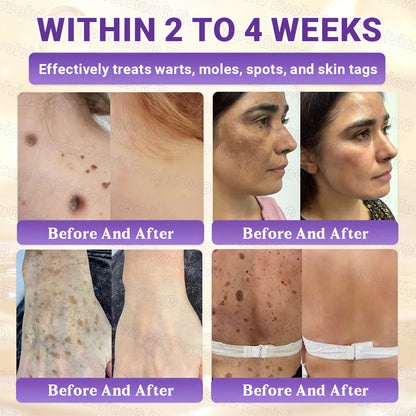 Made and Shipped from UK ✨Evolvion® Biotin 10-in-1 Skin Restoration Cream 🍀