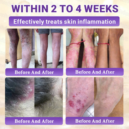 Made and Shipped from UK ✨Evolvion® Biotin 10-in-1 Skin Restoration Cream 🍀