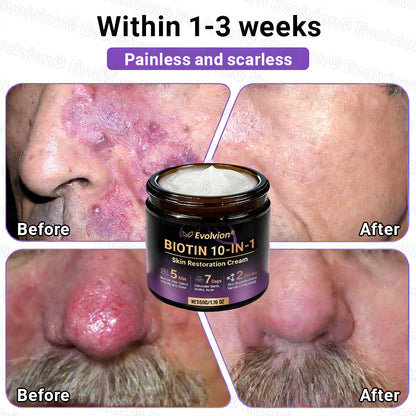 Made and Shipped from UK ✨Evolvion® Biotin 10-in-1 Skin Restoration Cream 🍀