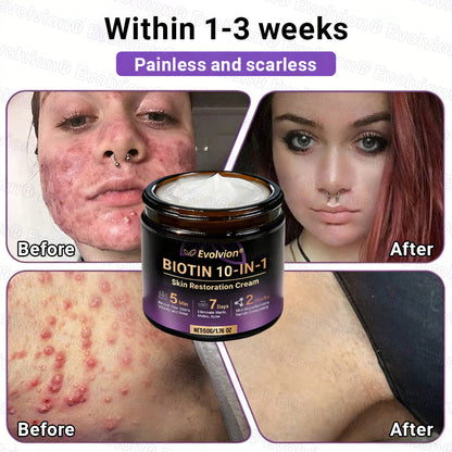 Made and Shipped from UK ✨Evolvion® Biotin 10-in-1 Skin Restoration Cream 🍀