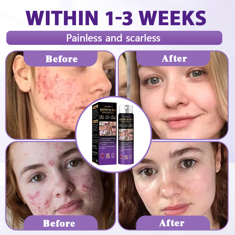 Made and shipped from the United Kingdom ✨Evolvion® Biotin 10-in-1 Skin Restoration Spray 🔥