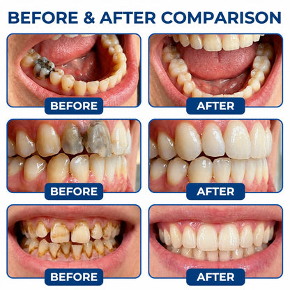 Dr.Fachmer®🦷 DentRestore Tooth Repair & Filling System📍