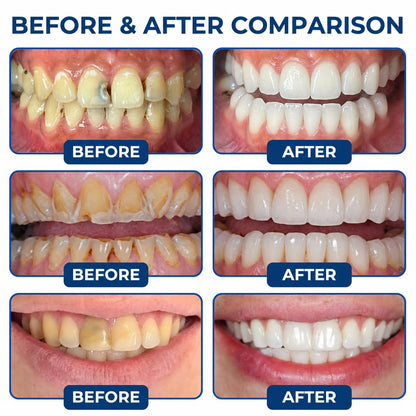 Dr.Fachmer®🦷 DentRestore Tooth Repair & Filling System📍